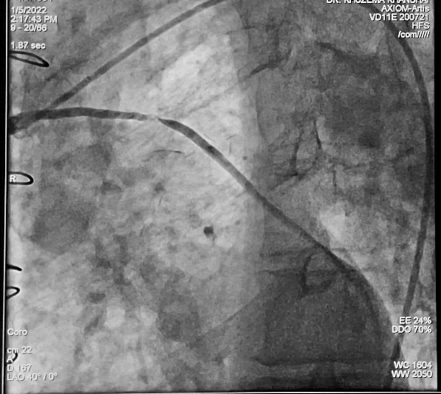 Interventional-Cardiology-Journal-SVG