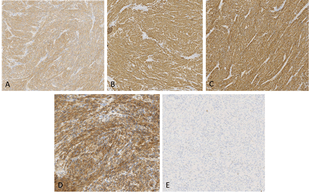 Research-Journal-Oncology-Immunohistochemical