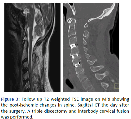 IPBJR-MRI