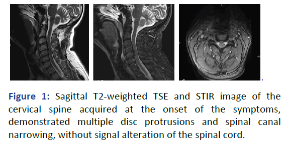 IPBJR-Sagittal