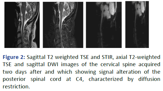 IPBJR-TSE