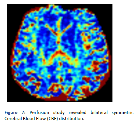 Imaging-Radiology-Perfusion