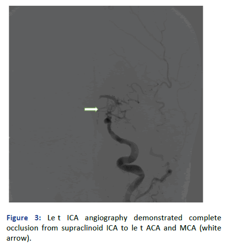 Imaging-Radiology-angiography