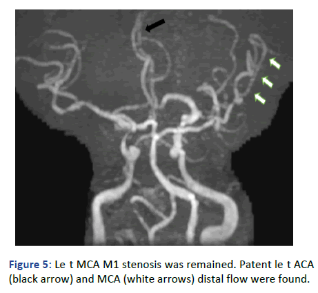 Imaging-Radiology-distal