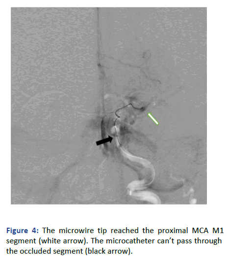 Imaging-Radiology-microwire