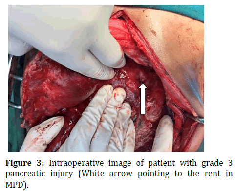 ipp-Intraoperative