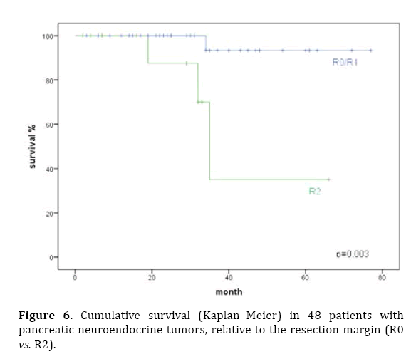 Pancreas-relative-resection-margin