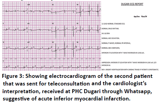 Quality-Primary-Care-electrocardiogram