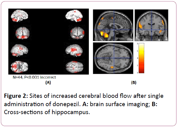 british-journal-Cross-sections-hippocampus