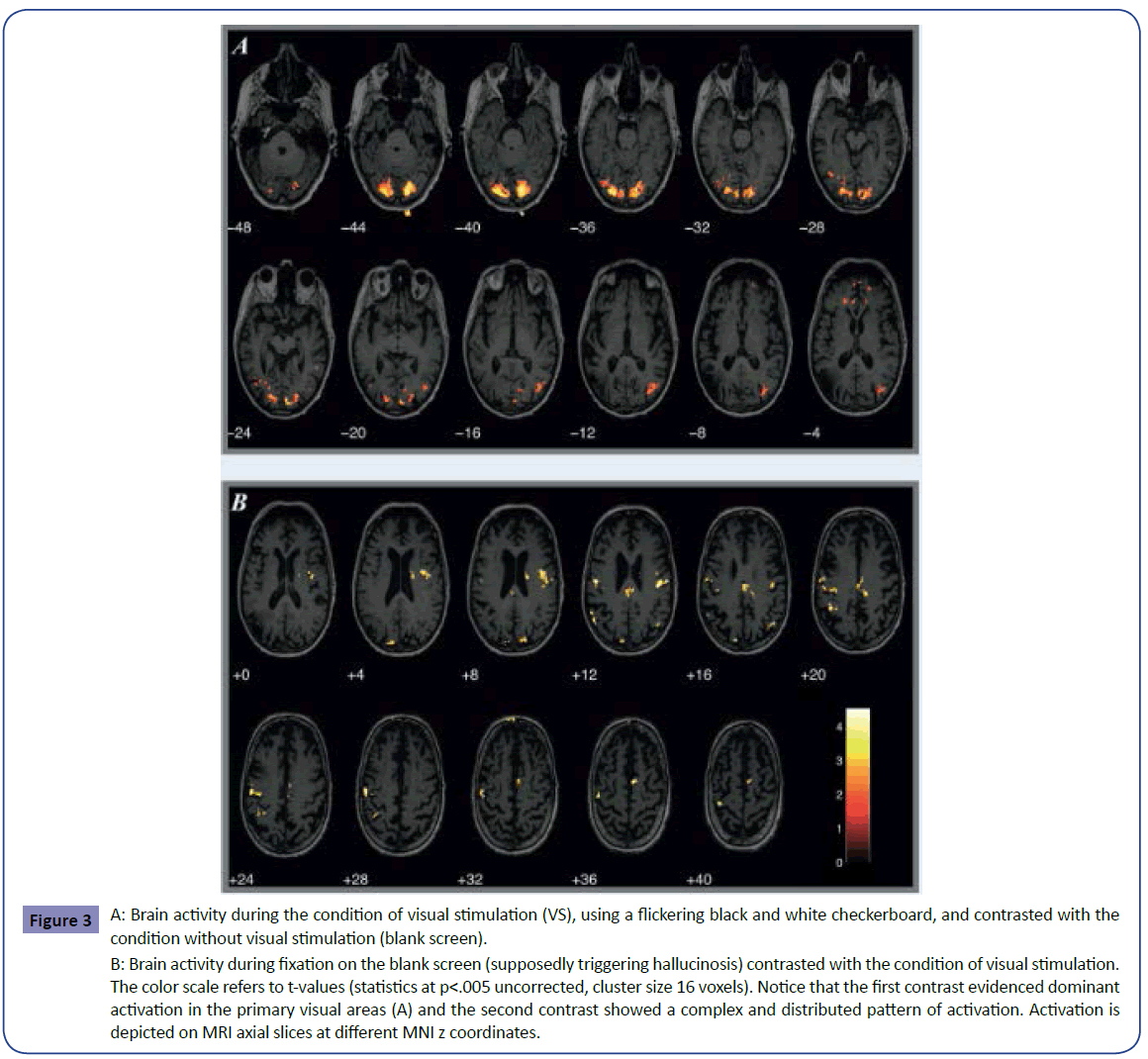 clinical-psychiatry-Brain-activity