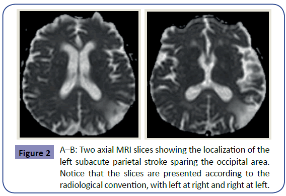 clinical-psychiatry-occipital-area