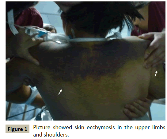 criticalcare-Picture-showed-skin