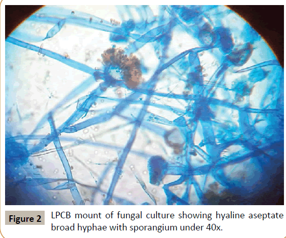 criticalcare-hyaline-aseptate