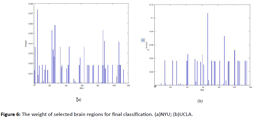 dual-diagnosis-brain-regions