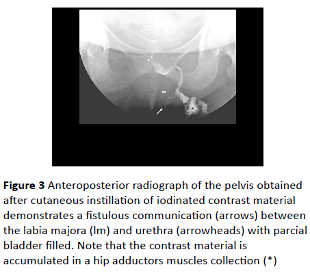 gynecology-obstetrics-Anteroposterior-radiograph