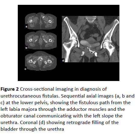 gynecology-obstetrics-Cross-sectional-imaging