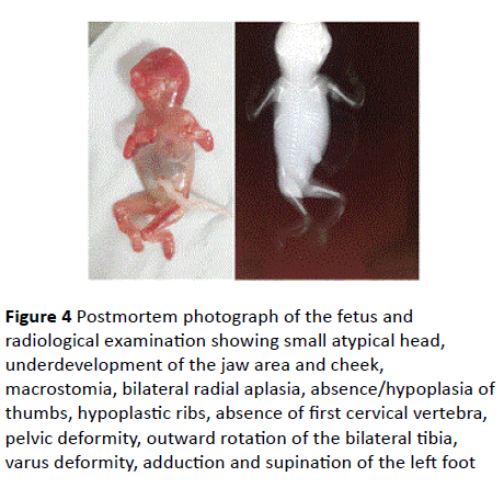 gynecology-obstetrics-Postmortem-photograph