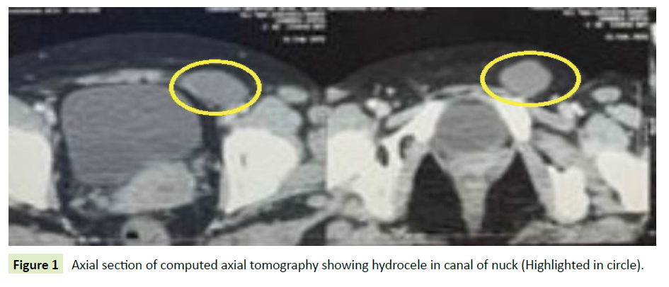 gynecology-obstetrics-axial-tomography