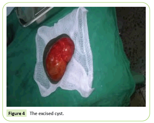 gynecology-obstetrics-excised