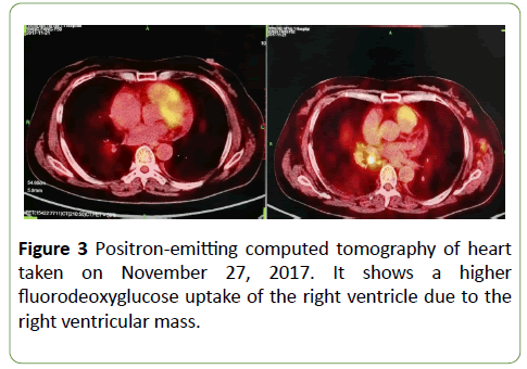 gynecology-obstetrics-fluorodeoxyglucose