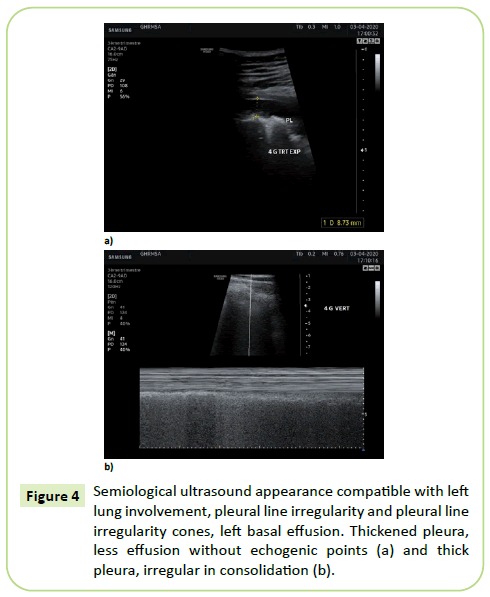 gynecology-obstetrics-semiological-ultrasound