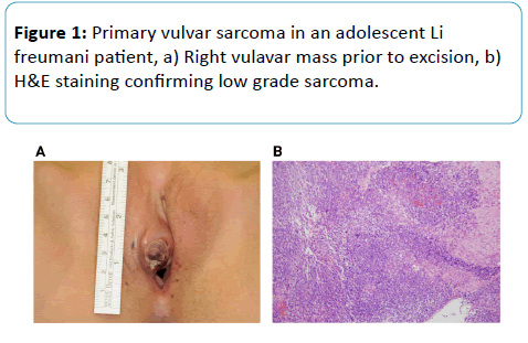 gynecology-obstetrics-staining-confirming