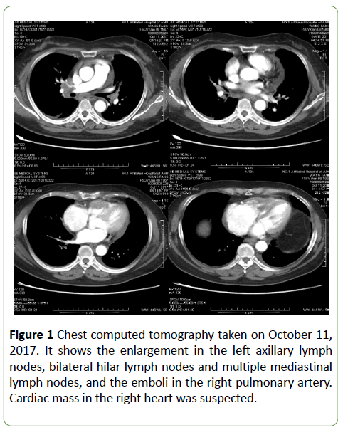 gynecology-obstetrics-tomography