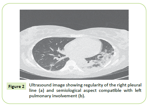 gynecology-obstetrics-ultrasound-image