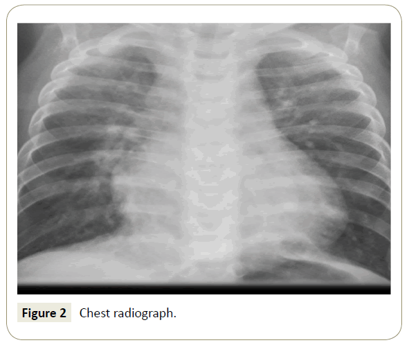 interventional-cardiology-Chest-radiograph