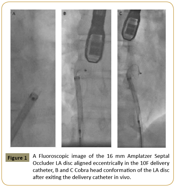 interventional-cardiology-Fluoroscopic-image