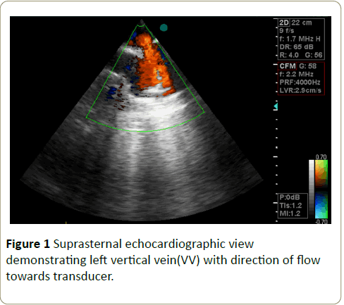 interventional-cardiology-Suprasternal