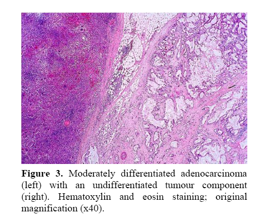 pancreas-Hematoxylin-eosin-staining