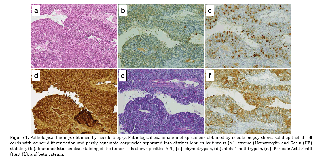 pancreas-Immunohistochemical-staining