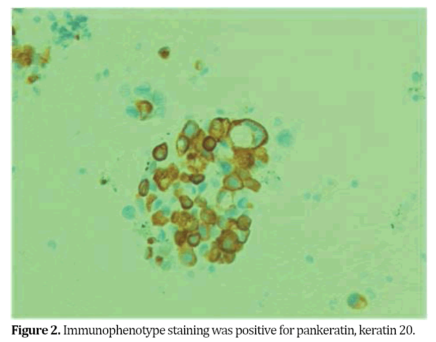 pancreas-Immunophenotype-staining