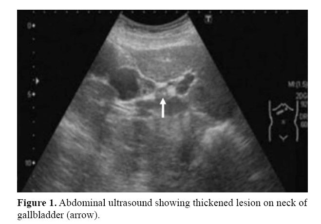 pancreas-abdominal-ultrasound