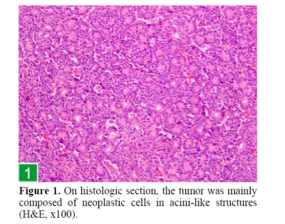 pancreas-acini-like-structures