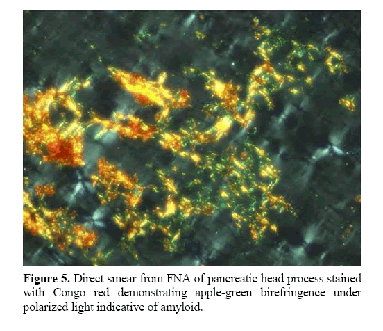 pancreas-apple-green-birefringence