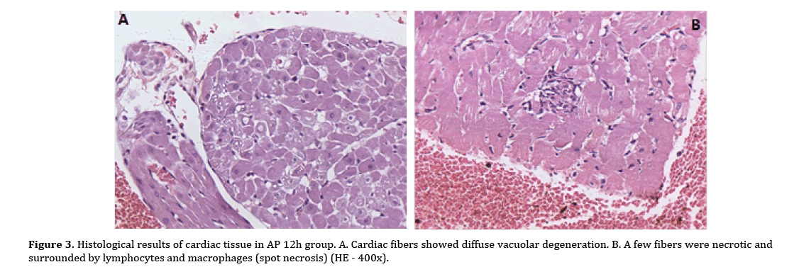 pancreas-cardiac-fibers-showed