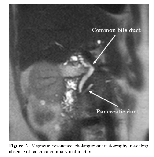 pancreas-cholangiopancreatography-revealing