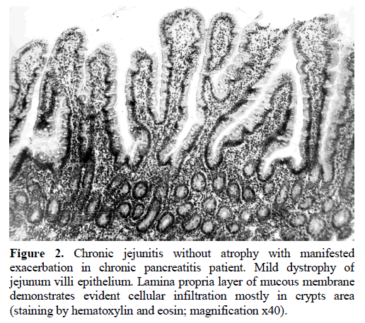 pancreas-chronic-jejunitis-pancreatitis