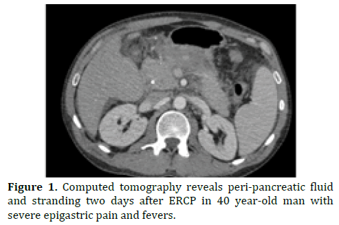 pancreas-computed-tomography-reveals