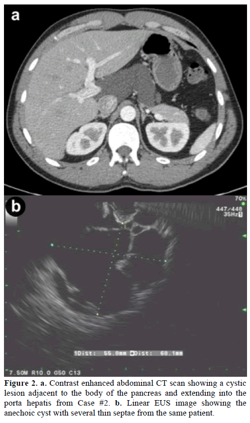 pancreas-contrast-enhanced-body-pancreas