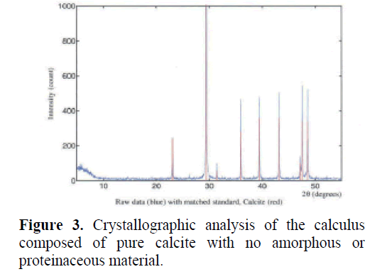 pancreas-crystallographic-analysis