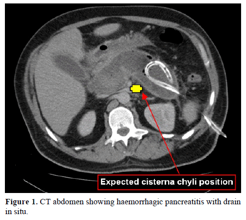 pancreas-ct-abdomen-haemorrhagic