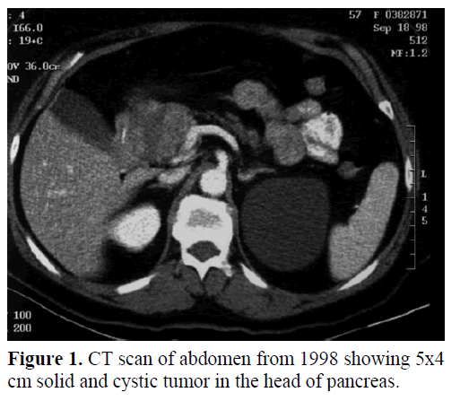 pancreas-ct-scan-abdomen-cystic-tumor