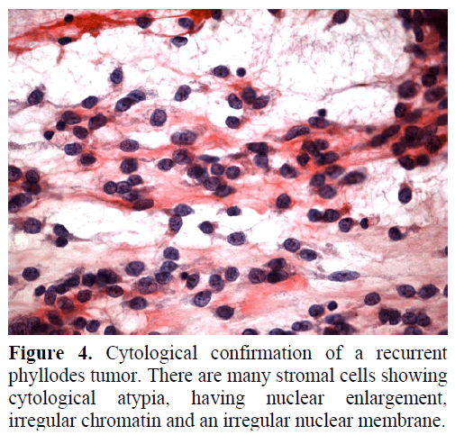 pancreas-cytological-confirmation-recurrent