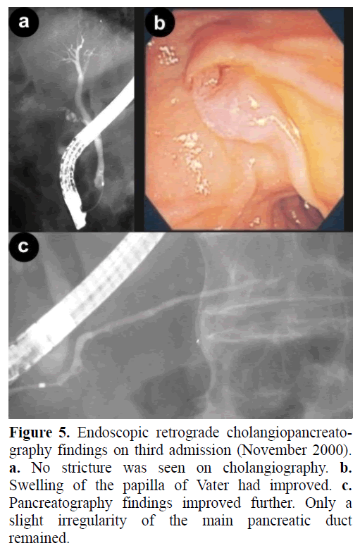 pancreas-endoscopic-retrograde-cholangiography
