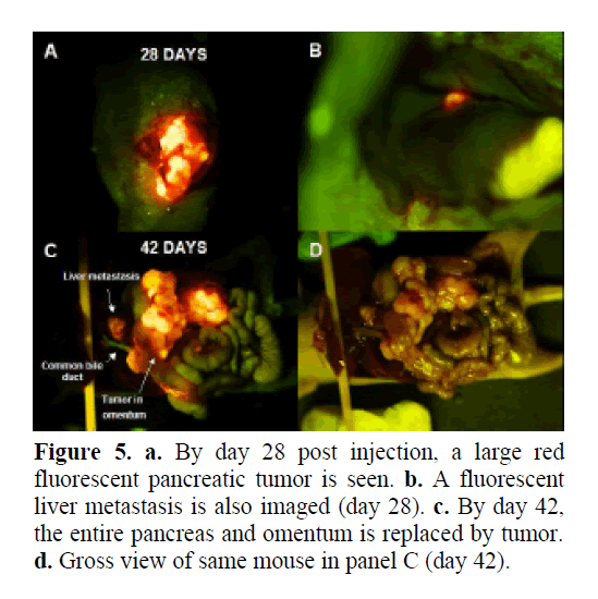 pancreas-fluorescent-pancreatic-tumor