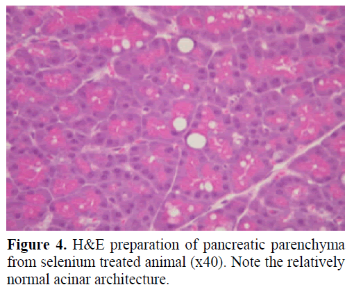 pancreas-he-preparation-parenchyma