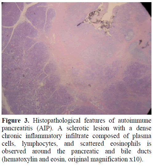 pancreas-histopathological-features-lesion